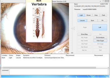 Analyseur médical d'iris d'oeil d'appareil photo numérique de Megapixel de portée d'iris de 12.0MP USB